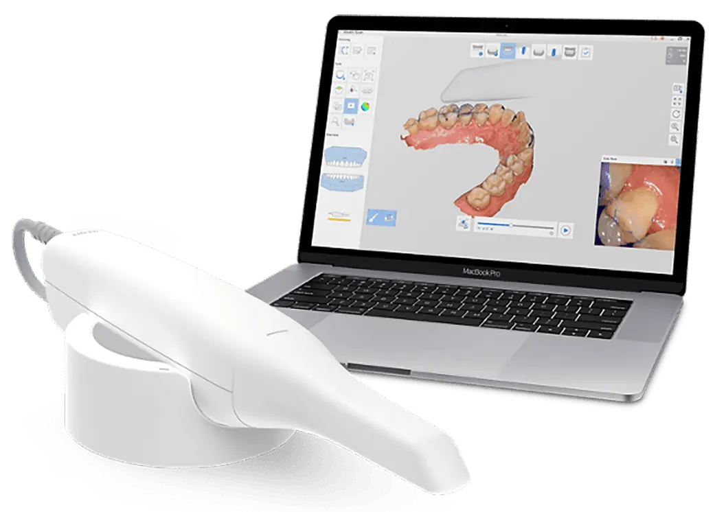 Kieferorthopaede dr alexander kuebert forabettersmile muenchen unterschleissheim intraoralscanner 3d scanner