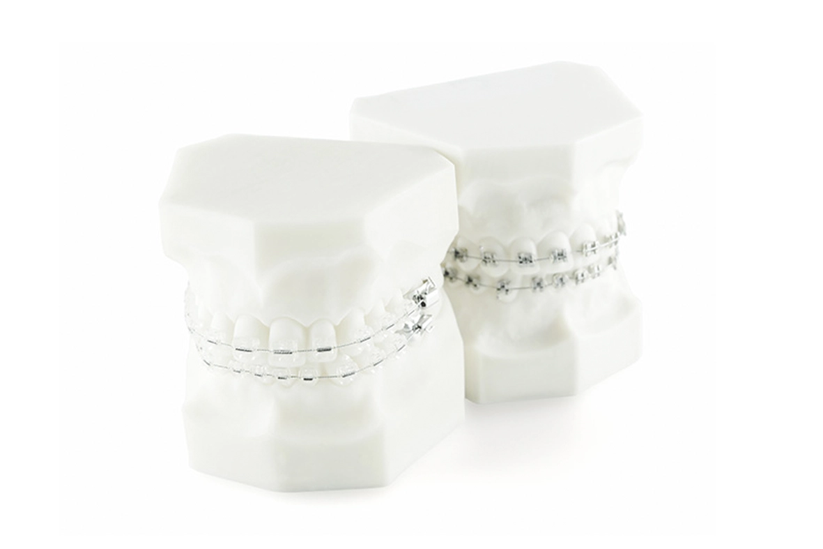 Kieferorthopaede dr david richter kressbronn am bodensee kinder jugendliche feste zahnspange keramikbrackets